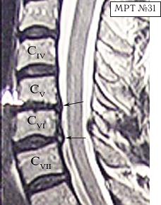 Иллюстрация к книге — Остеохондроз для профессионального пациента [i_063.jpg]