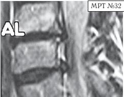 Иллюстрация к книге — Остеохондроз для профессионального пациента [i_064.jpg]