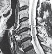 Иллюстрация к книге — Остеохондроз для профессионального пациента [i_071.jpg]