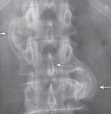 Иллюстрация к книге — Остеохондроз для профессионального пациента [i_072.jpg]