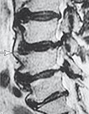 Иллюстрация к книге — Остеохондроз для профессионального пациента [i_073.jpg]