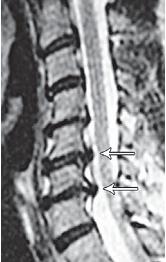 Иллюстрация к книге — Остеохондроз для профессионального пациента [i_074.jpg]