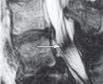 Иллюстрация к книге — Остеохондроз для профессионального пациента [i_077.jpg]