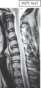 Иллюстрация к книге — Остеохондроз для профессионального пациента [i_079.jpg]