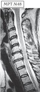 Иллюстрация к книге — Остеохондроз для профессионального пациента [i_080.jpg]