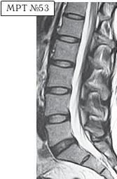 Иллюстрация к книге — Остеохондроз для профессионального пациента [i_085.jpg]