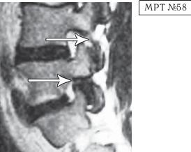 Иллюстрация к книге — Остеохондроз для профессионального пациента [i_088.jpg]