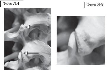 Иллюстрация к книге — Остеохондроз для профессионального пациента [i_090.jpg]