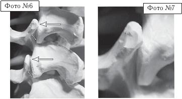 Иллюстрация к книге — Остеохондроз для профессионального пациента [i_091.jpg]