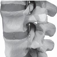 Иллюстрация к книге — Остеохондроз для профессионального пациента [i_093.jpg]