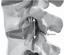 Иллюстрация к книге — Остеохондроз для профессионального пациента [i_095.jpg]
