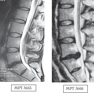 Иллюстрация к книге — Остеохондроз для профессионального пациента [i_098.jpg]