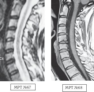 Иллюстрация к книге — Остеохондроз для профессионального пациента [i_099.jpg]