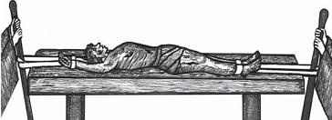 Иллюстрация к книге — Остеохондроз для профессионального пациента [i_101.jpg]