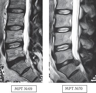 Иллюстрация к книге — Остеохондроз для профессионального пациента [i_105.jpg]