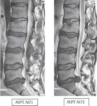 Иллюстрация к книге — Остеохондроз для профессионального пациента [i_106.jpg]