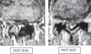 Иллюстрация к книге — Остеохондроз для профессионального пациента [i_111.jpg]
