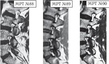 Иллюстрация к книге — Остеохондроз для профессионального пациента [i_112.jpg]