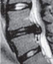 Иллюстрация к книге — Остеохондроз для профессионального пациента [i_116.jpg]
