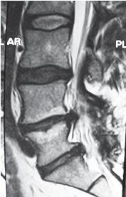Иллюстрация к книге — Остеохондроз для профессионального пациента [i_120.jpg]