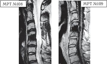 Иллюстрация к книге — Остеохондроз для профессионального пациента [i_123.jpg]