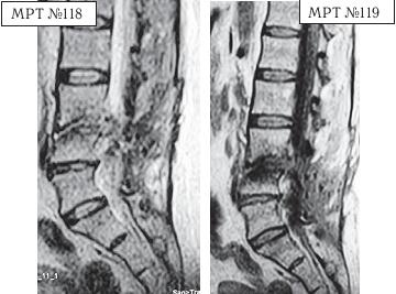 Иллюстрация к книге — Остеохондроз для профессионального пациента [i_128.jpg]