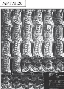 Иллюстрация к книге — Остеохондроз для профессионального пациента [i_132.jpg]