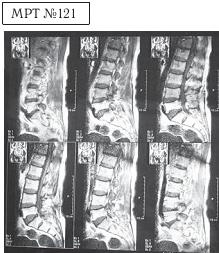 Иллюстрация к книге — Остеохондроз для профессионального пациента [i_134.jpg]