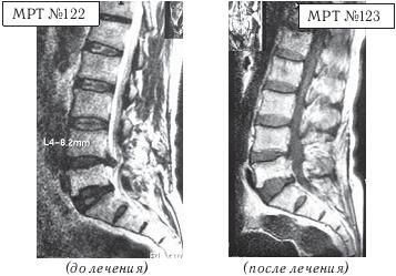 Иллюстрация к книге — Остеохондроз для профессионального пациента [i_135.jpg]