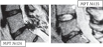 Иллюстрация к книге — Остеохондроз для профессионального пациента [i_136.jpg]