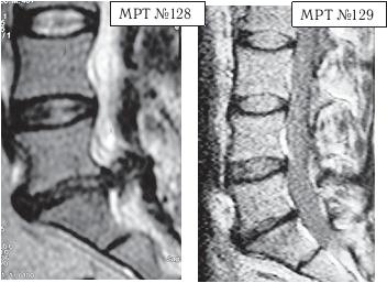 Иллюстрация к книге — Остеохондроз для профессионального пациента [i_138.jpg]