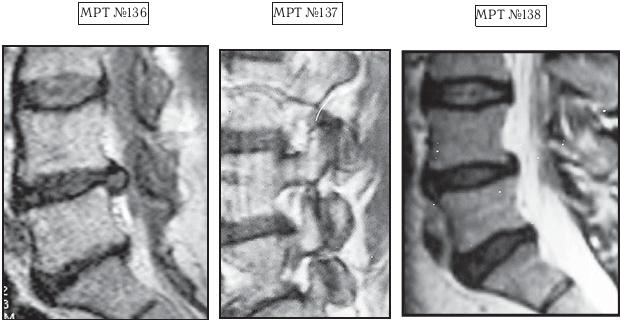 Иллюстрация к книге — Остеохондроз для профессионального пациента [i_142.jpg]