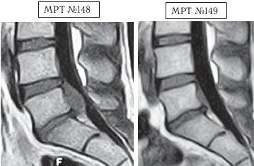 Иллюстрация к книге — Остеохондроз для профессионального пациента [i_147.jpg]