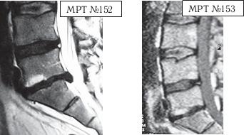 Иллюстрация к книге — Остеохондроз для профессионального пациента [i_149.jpg]