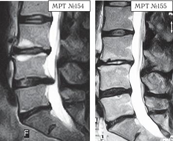 Иллюстрация к книге — Остеохондроз для профессионального пациента [i_150.jpg]