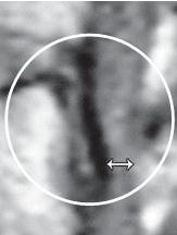 Иллюстрация к книге — Остеохондроз для профессионального пациента [i_153.jpg]