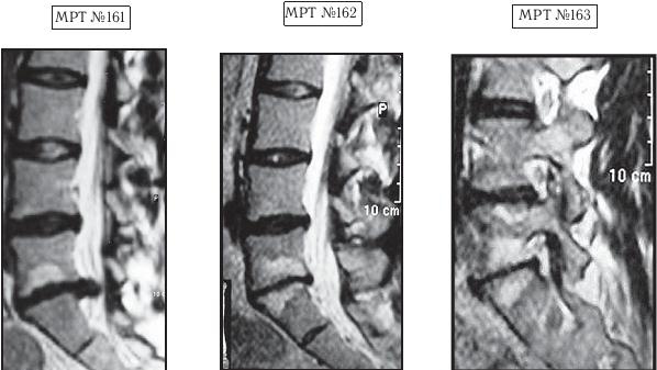 Иллюстрация к книге — Остеохондроз для профессионального пациента [i_154.jpg]