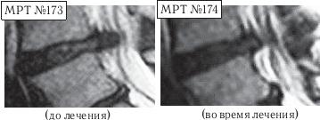 Иллюстрация к книге — Остеохондроз для профессионального пациента [i_159.jpg]