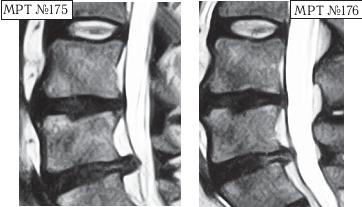 Иллюстрация к книге — Остеохондроз для профессионального пациента [i_160.jpg]