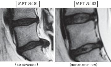 Иллюстрация к книге — Остеохондроз для профессионального пациента [i_163.jpg]