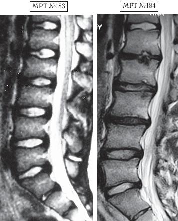 Иллюстрация к книге — Остеохондроз для профессионального пациента [i_164.jpg]