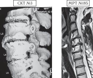 Иллюстрация к книге — Остеохондроз для профессионального пациента [i_165.jpg]