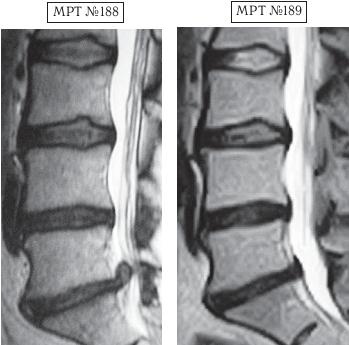 Иллюстрация к книге — Остеохондроз для профессионального пациента [i_167.jpg]