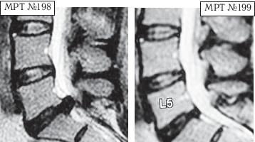 Иллюстрация к книге — Остеохондроз для профессионального пациента [i_172.jpg]