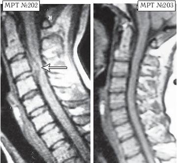 Иллюстрация к книге — Остеохондроз для профессионального пациента [i_174.jpg]