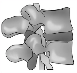 Иллюстрация к книге — Остеохондроз. Как победить боль [i_004.jpg]