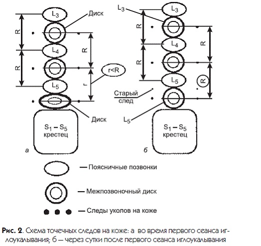 Иллюстрация к книге — Новый взгляд на остеохондроз. Причины и лечение [i_001.jpg]
