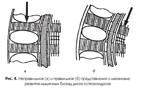 Иллюстрация к книге — Новый взгляд на остеохондроз. Причины и лечение [i_004.jpg]