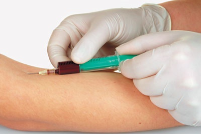 Иллюстрация к книге — О чем говорят анализы. Секреты медицинских показателей - для пациентов [i_020.jpg]