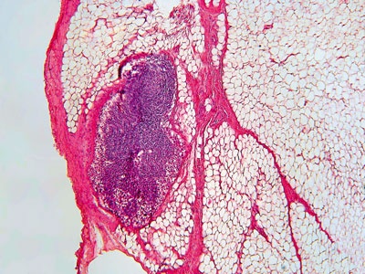 Иллюстрация к книге — О чем говорят анализы. Секреты медицинских показателей - для пациентов [i_027.jpg]